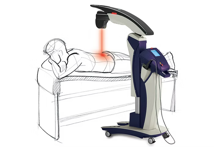 MLS laser