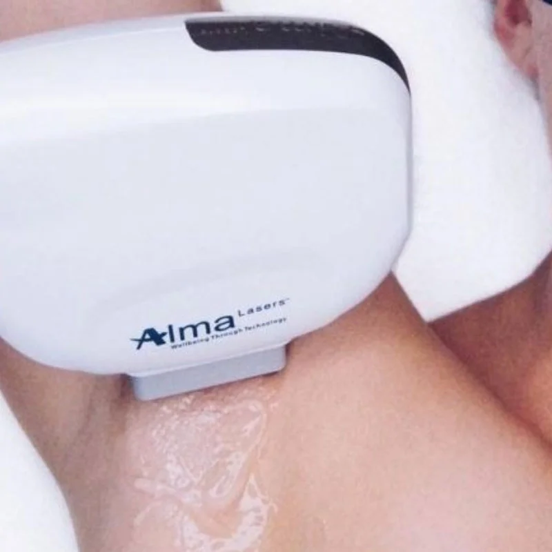 alma laser device